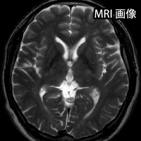 MRI画像：頭痛外来