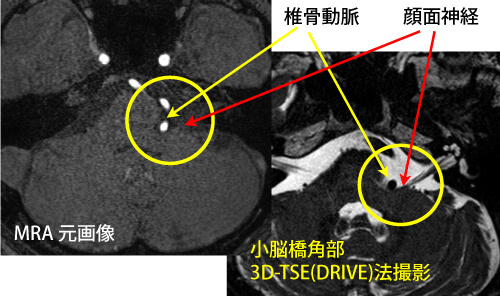 検査画像