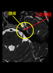 検査画像