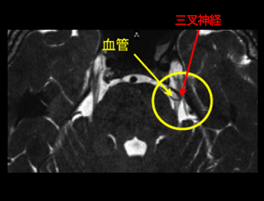 検査画像